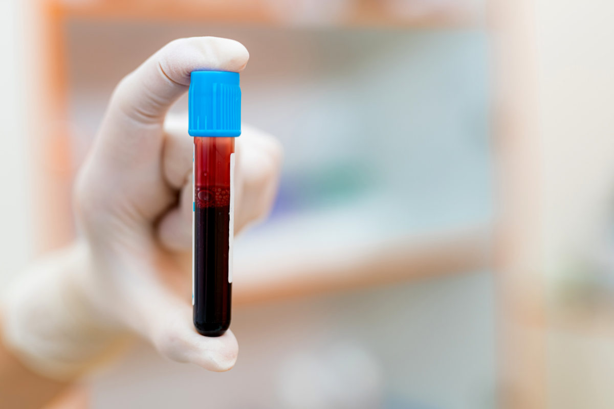 Interferentes biológicos em testes rápidos