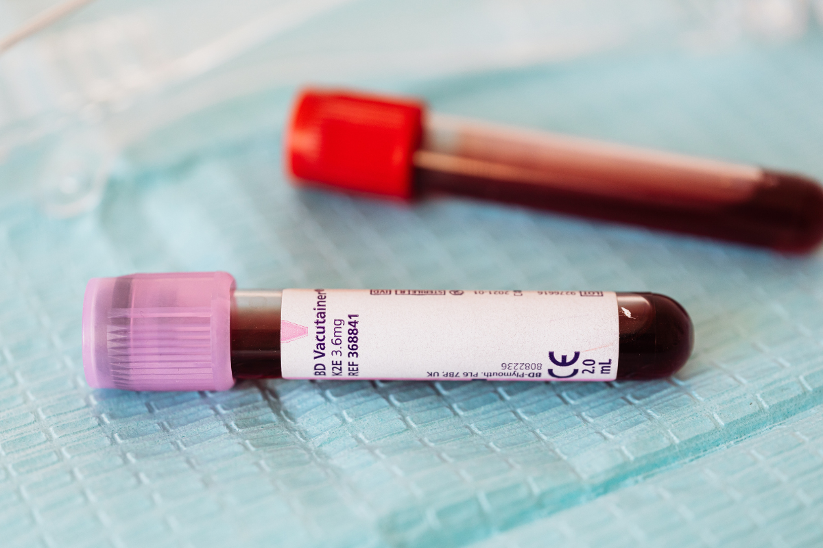 Como a tecnologia fluido-free eleva a confiabilidade dos analisadores de gases sanguíneos