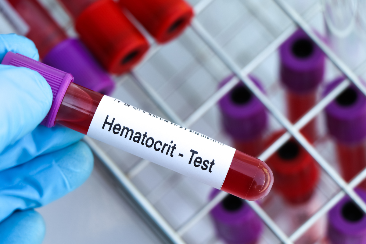 relação entre hematócrito e diagnóstico rápido