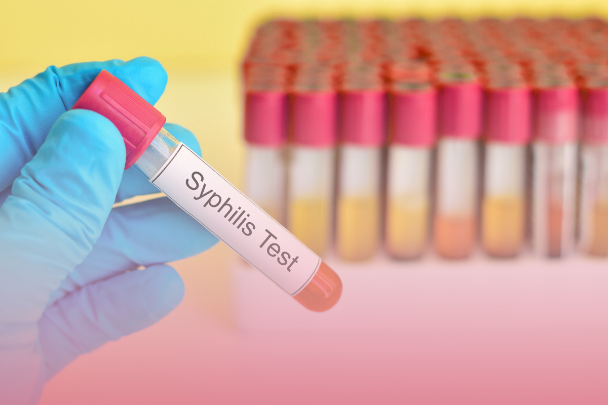 Outubro Verde a urgência do diagnóstico da sífilis