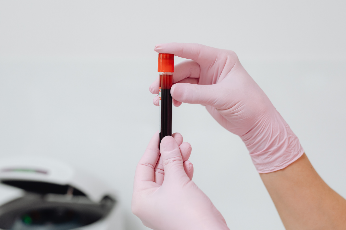 Marcadores inflamatórios laboratoriais auxiliam decisões clínicas
